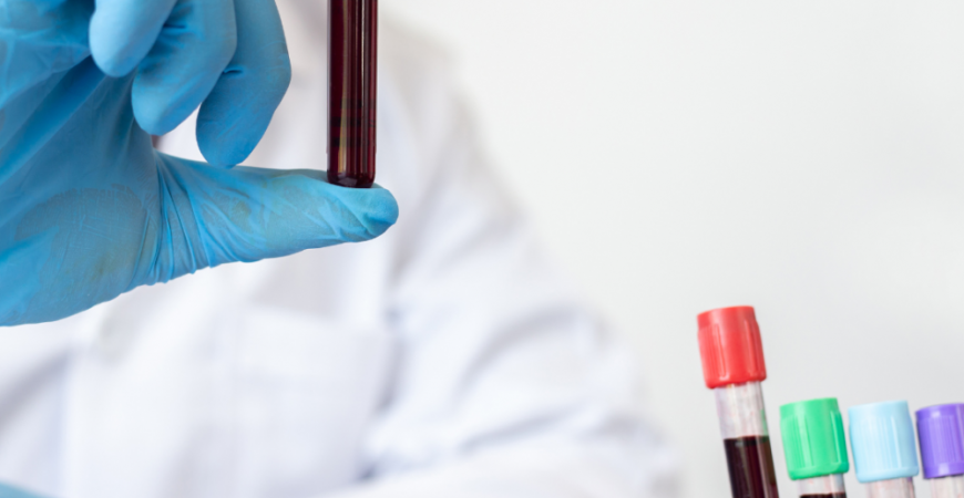 Liquid Biopsy – its impact on the field of Oncology