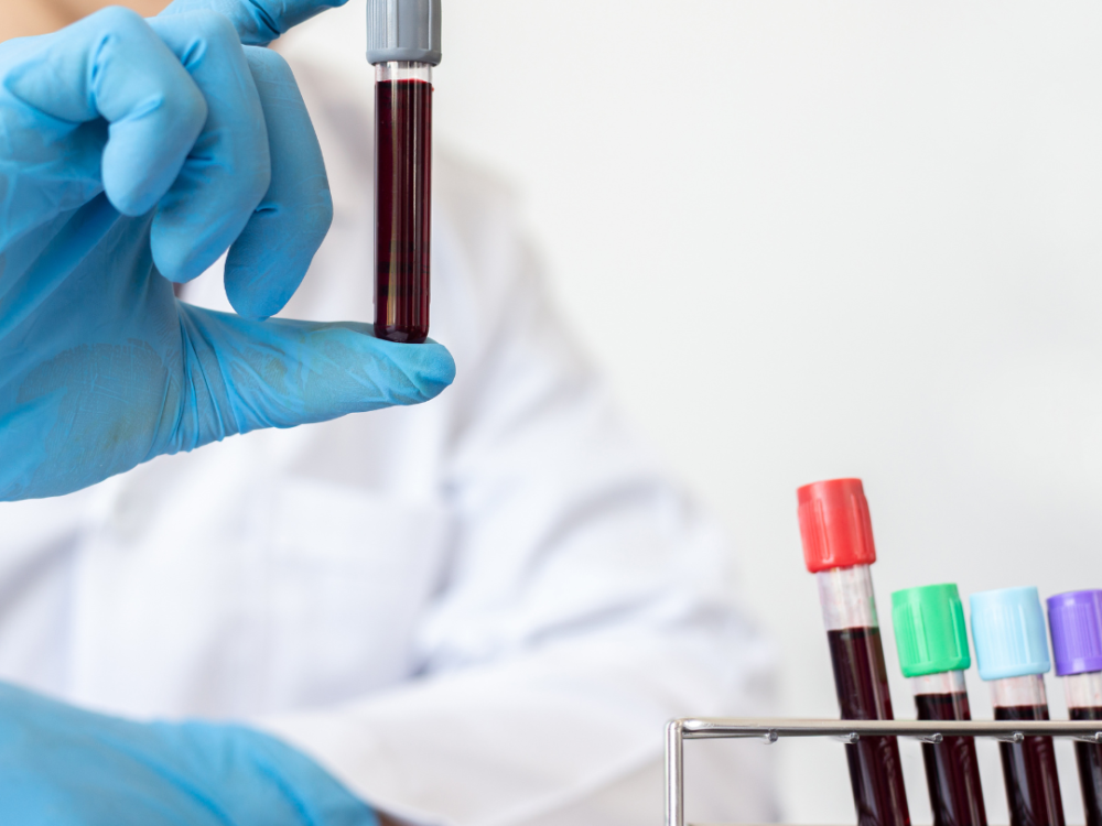 Liquid Biopsy – its impact on the field of Oncology